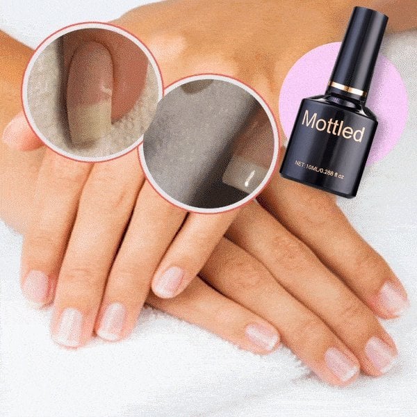 🔥2024 NAIL REPAIR PROTECTION GEL