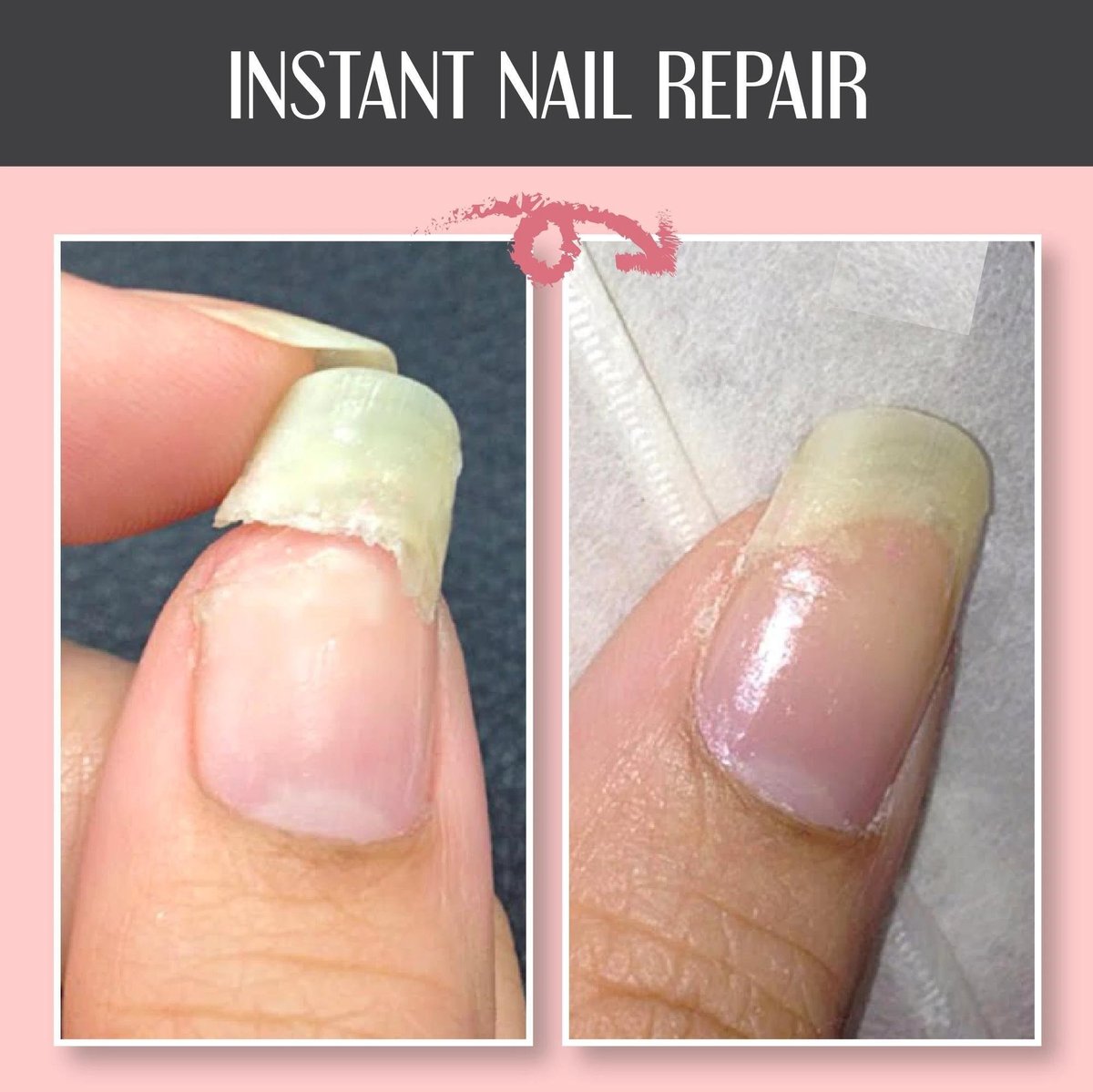 🔥2024 NAIL REPAIR PROTECTION GEL