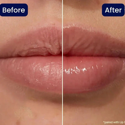 🔥😍Lip Serum✨Buy 3 Get 2 Free (5 pcs)