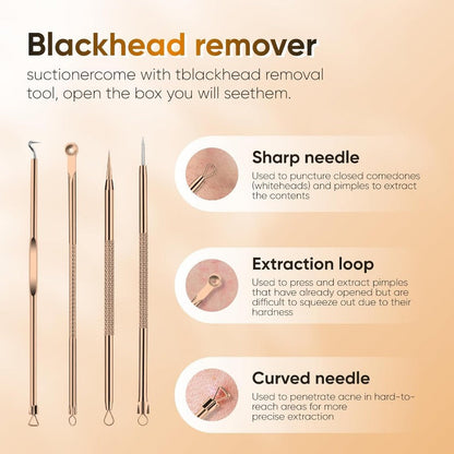 Rechargeable Pore Vacuum – 6-in-1 Blackhead Remover with Smart Display & Extraction Kit