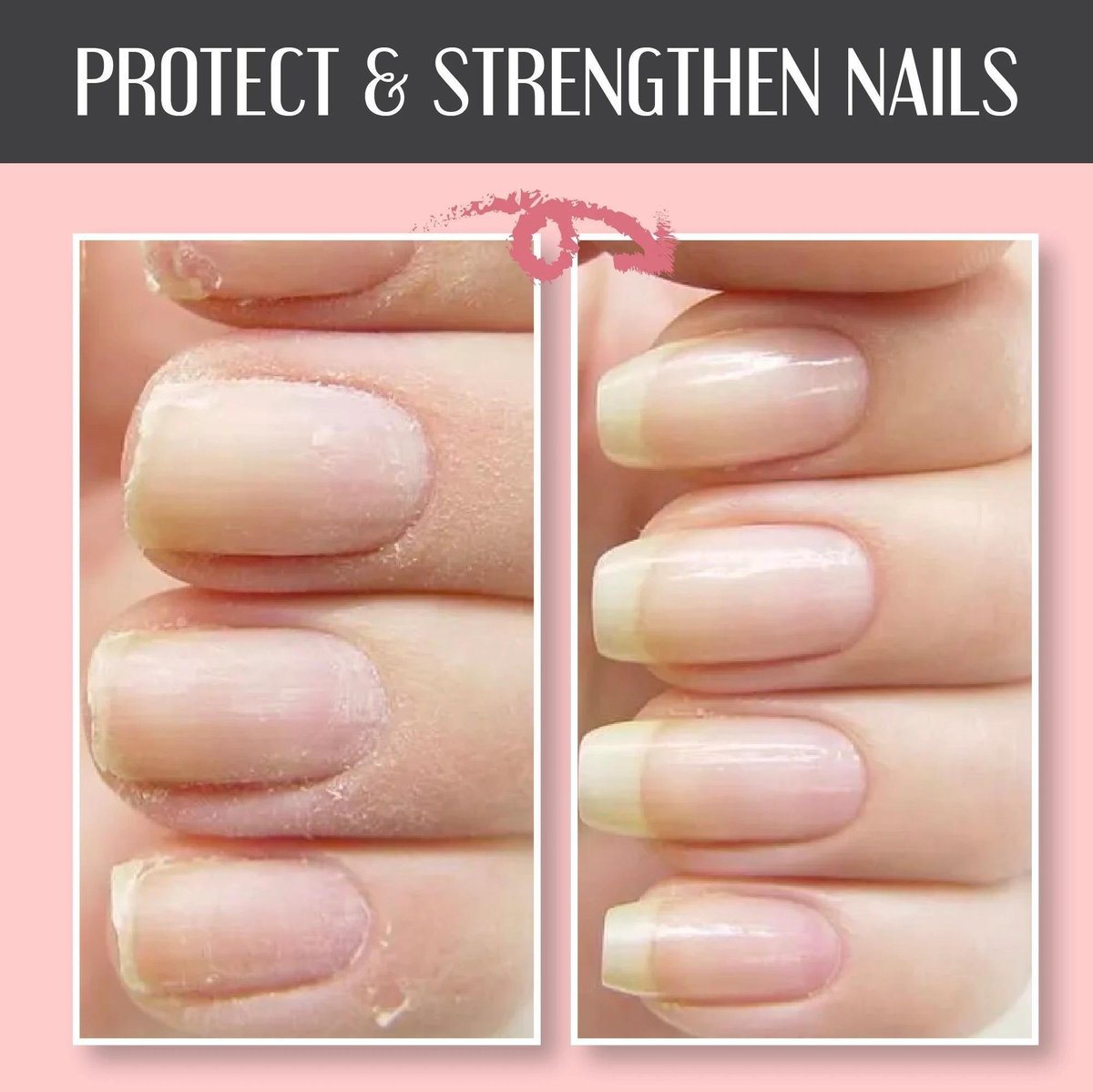 🔥2024 NAIL REPAIR PROTECTION GEL