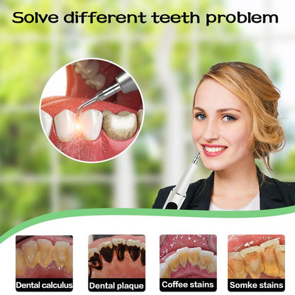 Ultrasonic Electric Tooth Cleaner